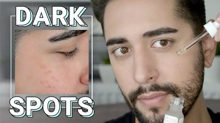 Dark spots