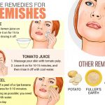 remove skin blemishes